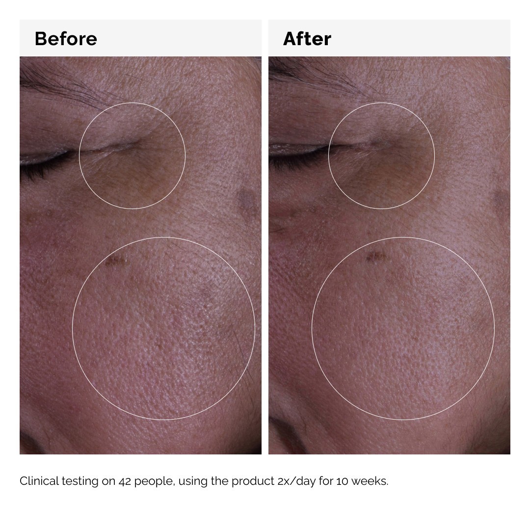 The Ordinary Anti-Aging Serum GF Solution 15% - 30 ml