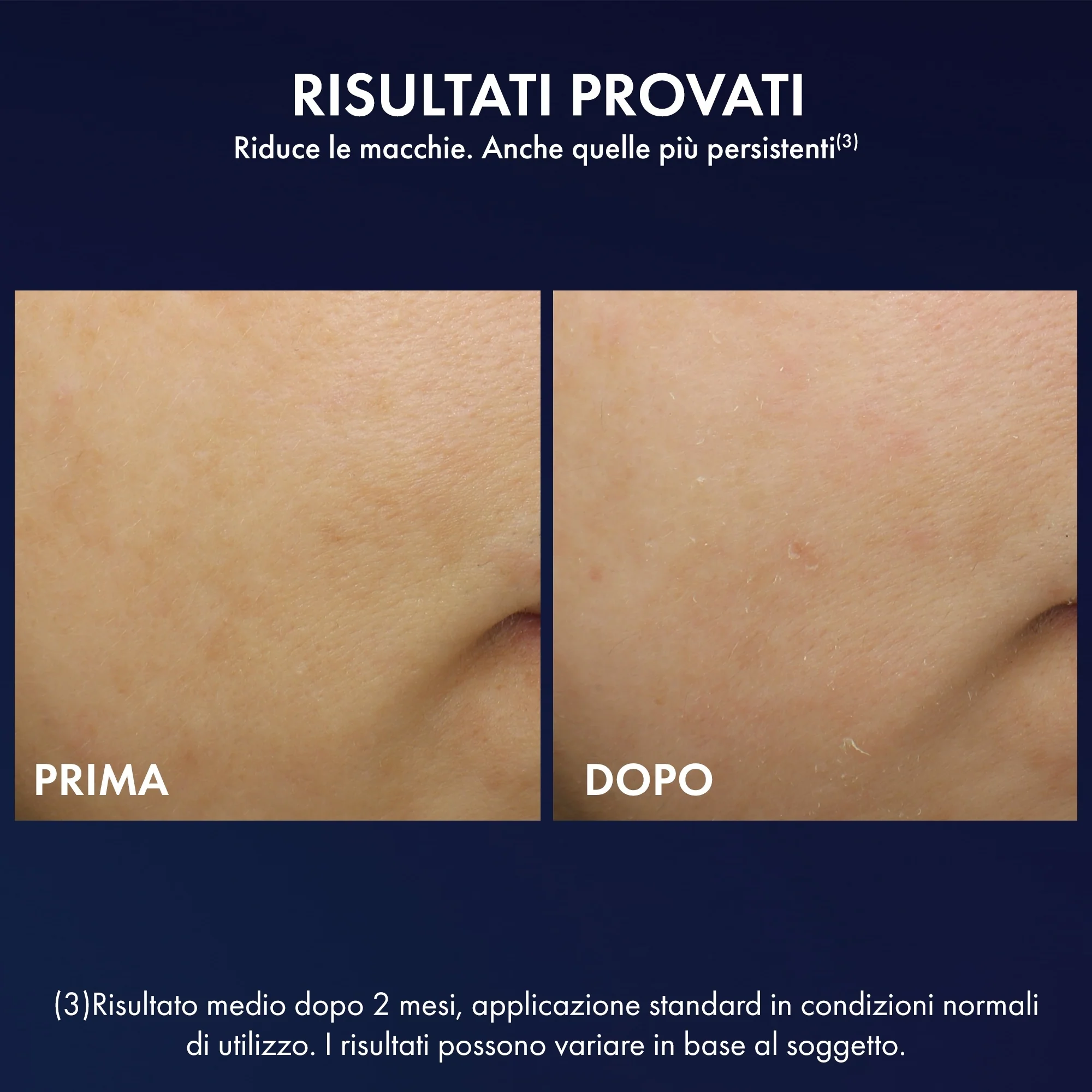 Liftactiv Liftactiv B3 Crema Notte con Retinolo - Tratt.viso notte antirughe