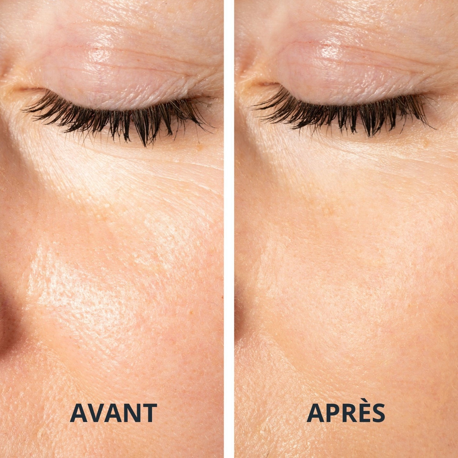 Algologie Base lissante effet flouteur