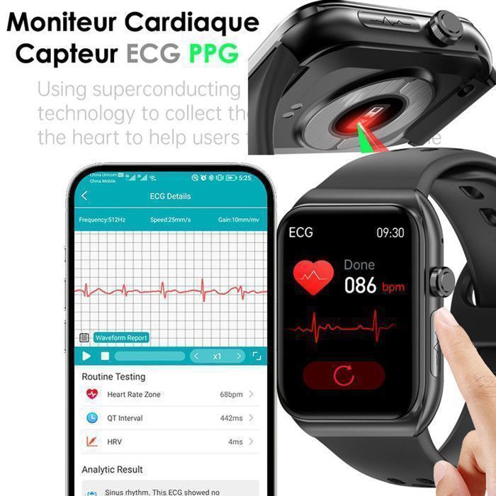Smartwatch XtraDiTech con ECG, cardiofrequenzimetro, termometro e monitoraggio multiparametrico, schermo rettangolare HD da 1,81