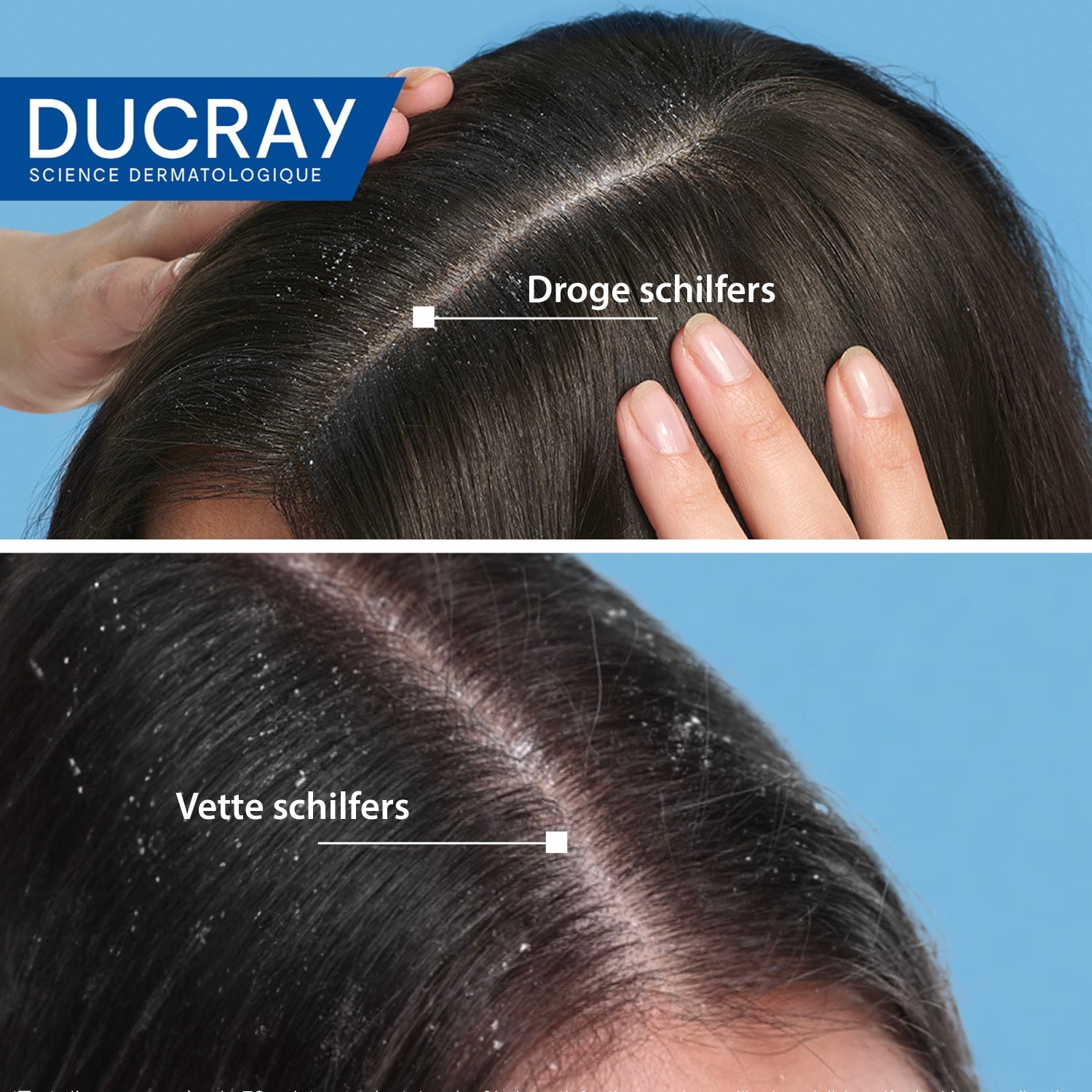 „Ducray Scalp Care KELUAL SQUANORM“ gaivinantis losjonas galvos odai, 200 ml