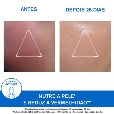 Uriage Xémose Crème Visage Erittäin kuivalle tai atooppiselle iholle tarkoitettu rauhoittava voide 40 ml 40 ml