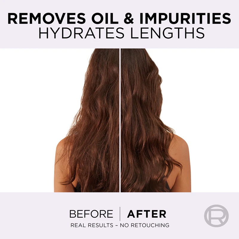 Shampoo hidratante L'Oréal Paris Elseve Hyaluron Pure para couro cabeludo oleoso e pontas secas.
