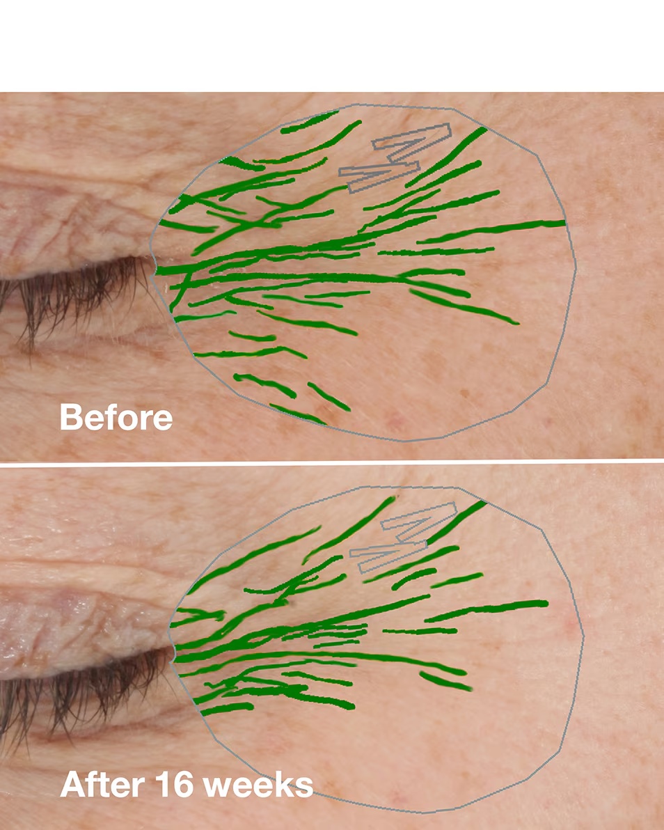 CLINIQUE CLINIQUE SMART CLINICAL REPAIR™ HIDRATANTNA KREMA ZA ISPRAVKU BORA PROTIV STARENJA - ZA SUHU KOŽU