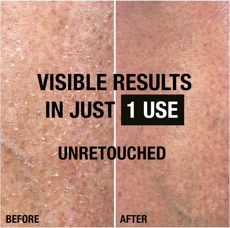 Neutrogena Norwegian Formula® intensīvi atjaunojošs ķermeņa piens sausai ādai