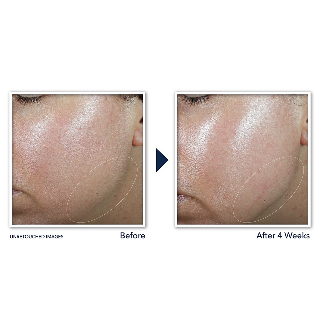 RoC noćna krema Derm Correxion krema za konture - 50 ml