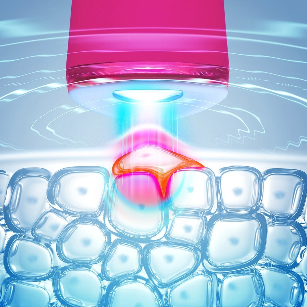 FOREO ESPADA™ 2 sejas masieris – 1 gab.