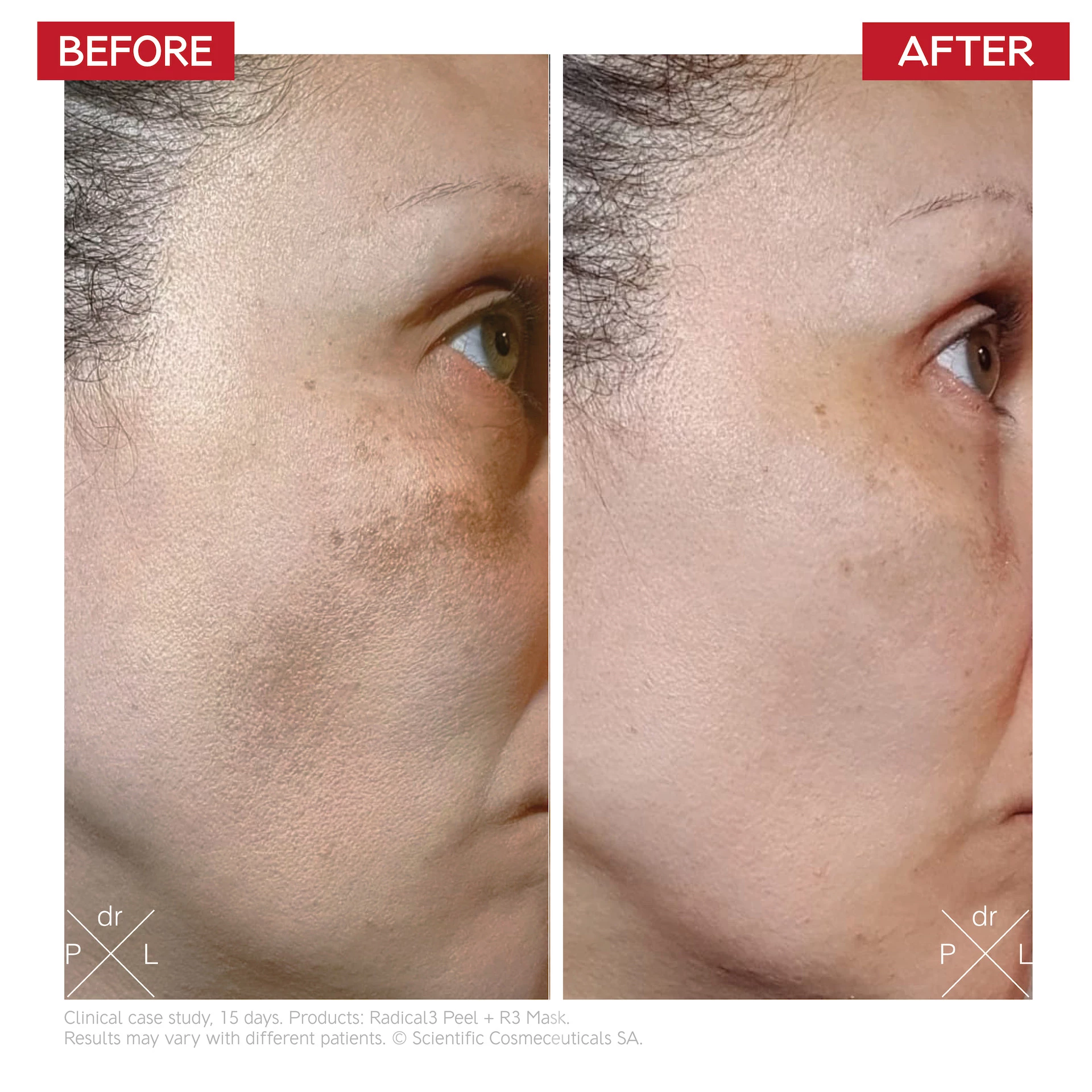 Radical3 Reboot Pro Peel 50 ml - Dr. LEVY Elveția