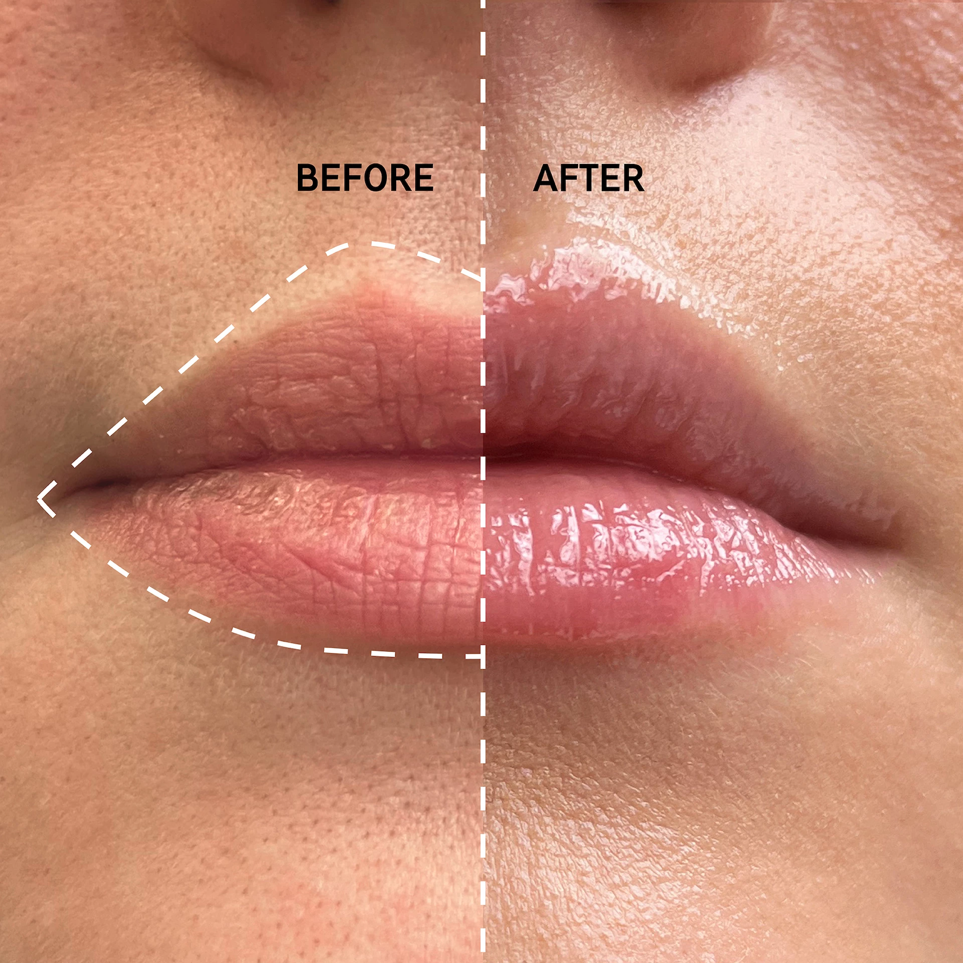 Balsam de buze cu tripeptide - Lista INKEY