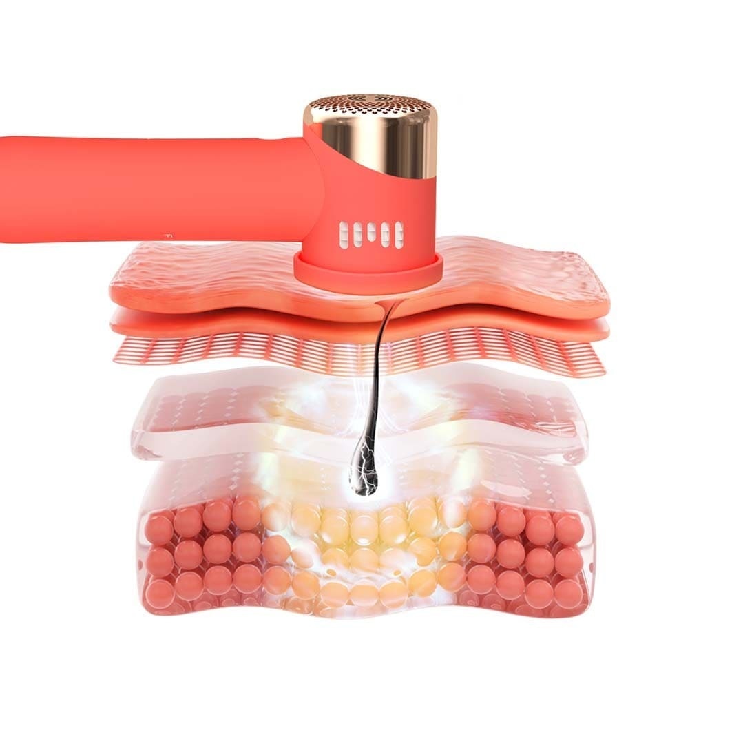 FOREO Epilátor PEACH™ PEACH™ 2 go Peach – Pokročilý, cestovný IPL prístroj na trvalé odstránenie chĺpkov s chladiacim systémom – 1 kus