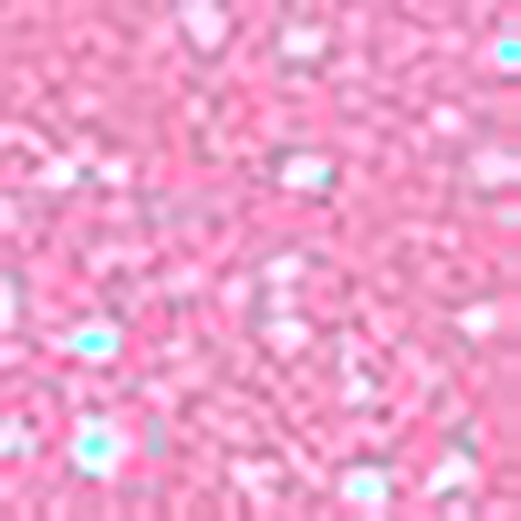 Catrice Drunk'n Diamonds Plumping baume à lèvres repulpant éclat 010 Guilty Treasure