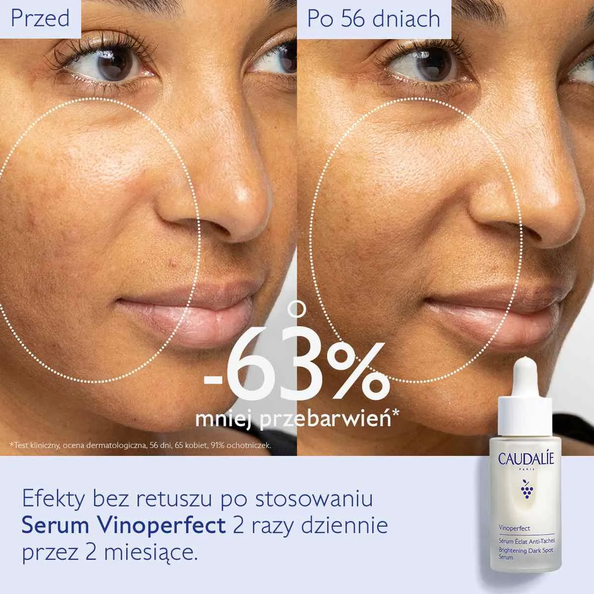 Caudalie Vinoperfect Serum rozjaśniające przebarwienia