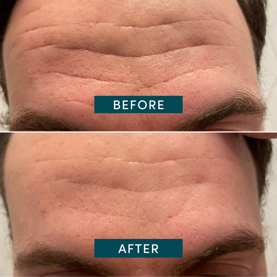 Aprikožu pretnovecošanās maska, kokvilnas sejas spilventiņi ar niacinamīdu – 100 g iepakojumā