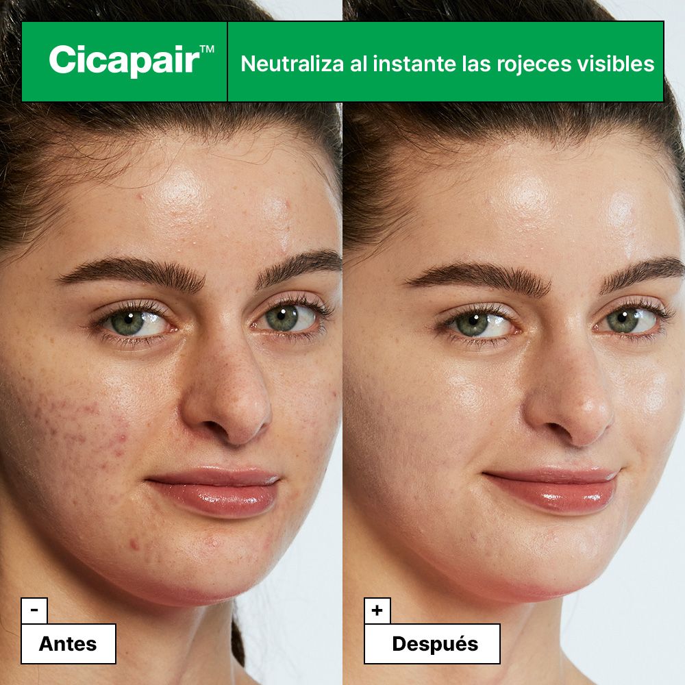 Cicapair Tiger Grass korektivni tretma za barvo proti rdečici Luksuzni ciljno usmerjeni tretmaji