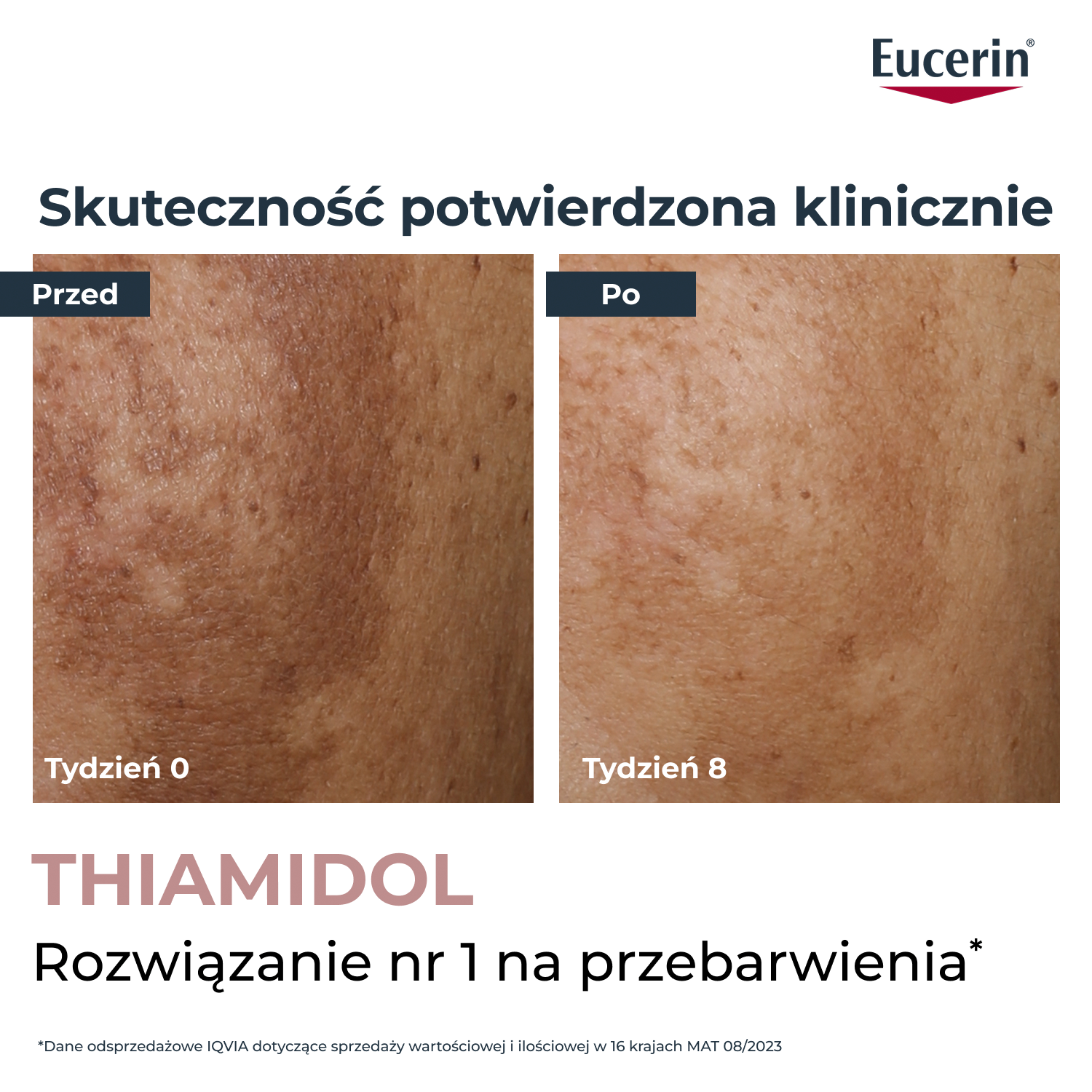 Eucerin Anti-Pigment