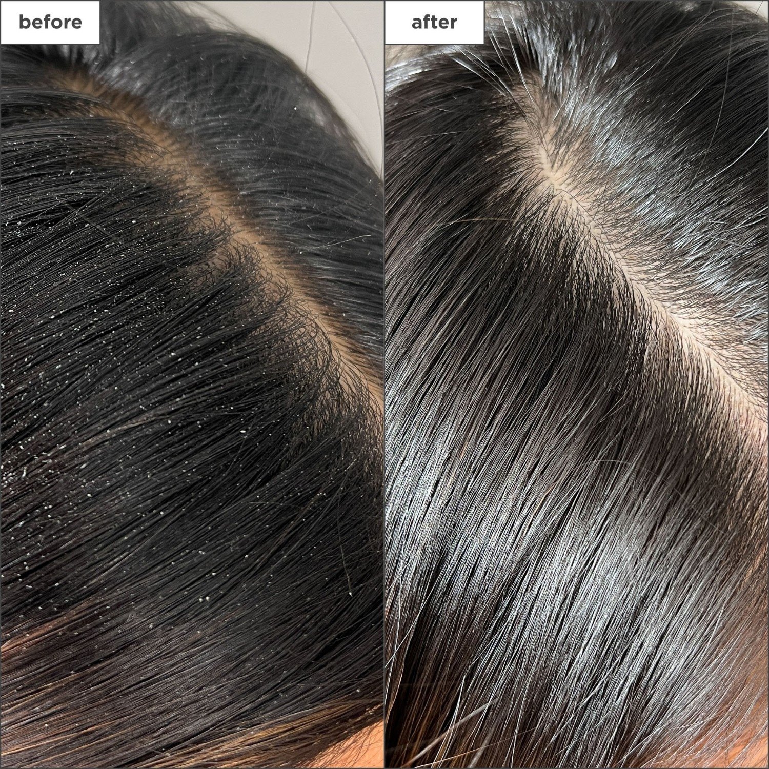 Briogeo Hair Fluid Scalp Revival™ Detoks sprej s aktivnim ugljenom i uljem čajevca - 120 ml