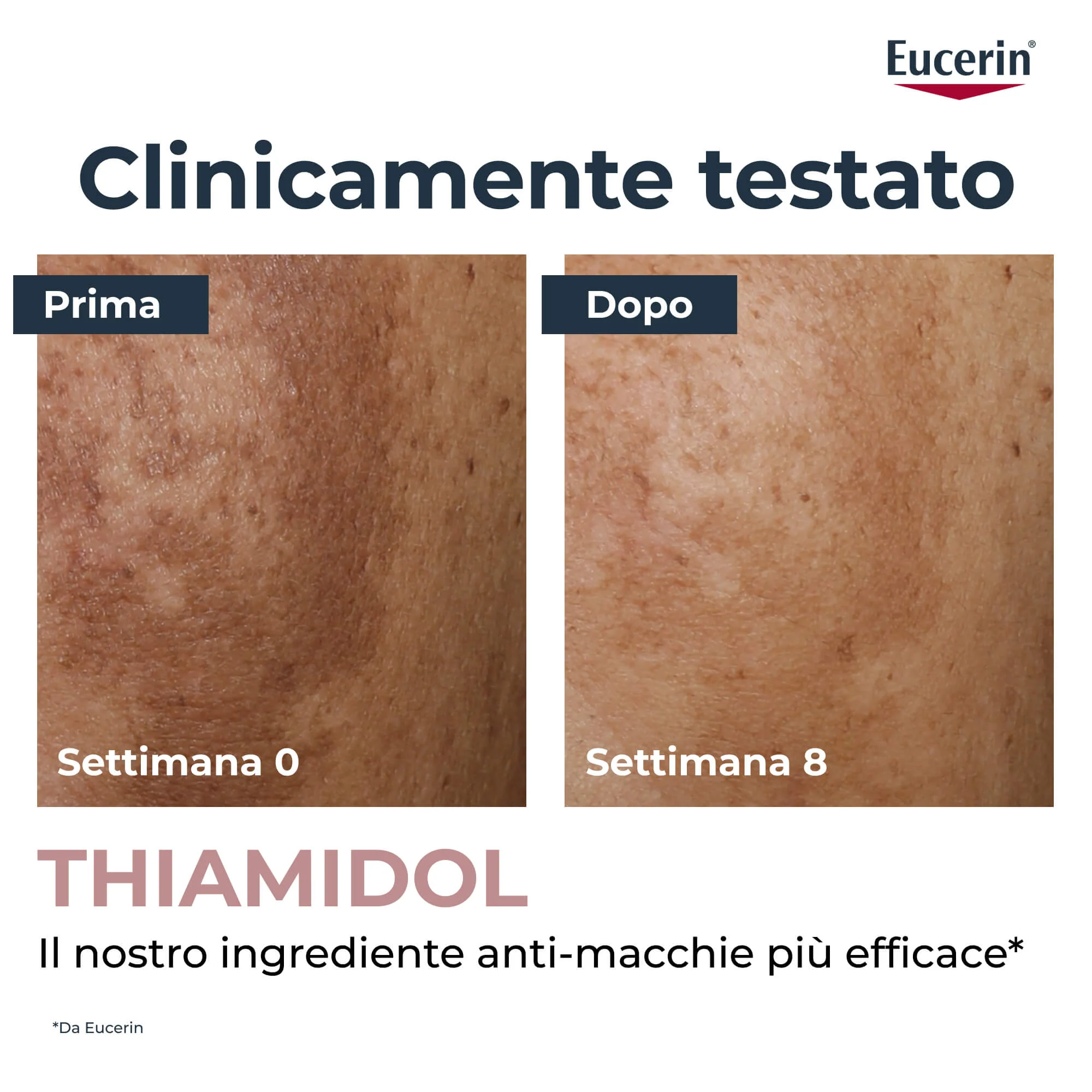 Anti-Pigment Anti-Pigment Correttore - Stick antimacchie