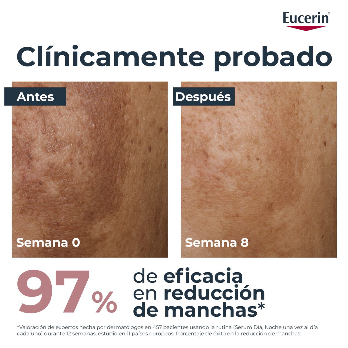 Dvostruki serum protiv pigmentacije Kreme protiv mrlja