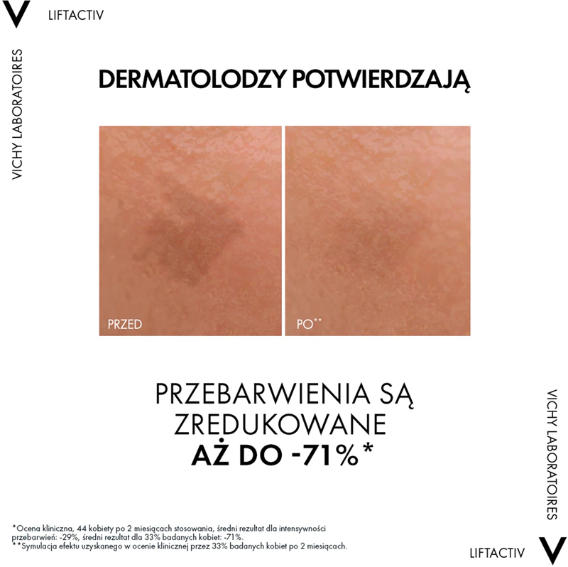 Sérum facial Vichy Liftactiv Pigment Specialist B3 contra manchas na pele