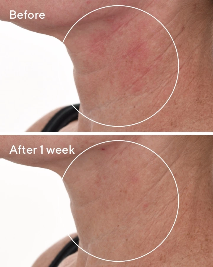 Sejthidratáló regeneráló szérum 30 ml - Murad