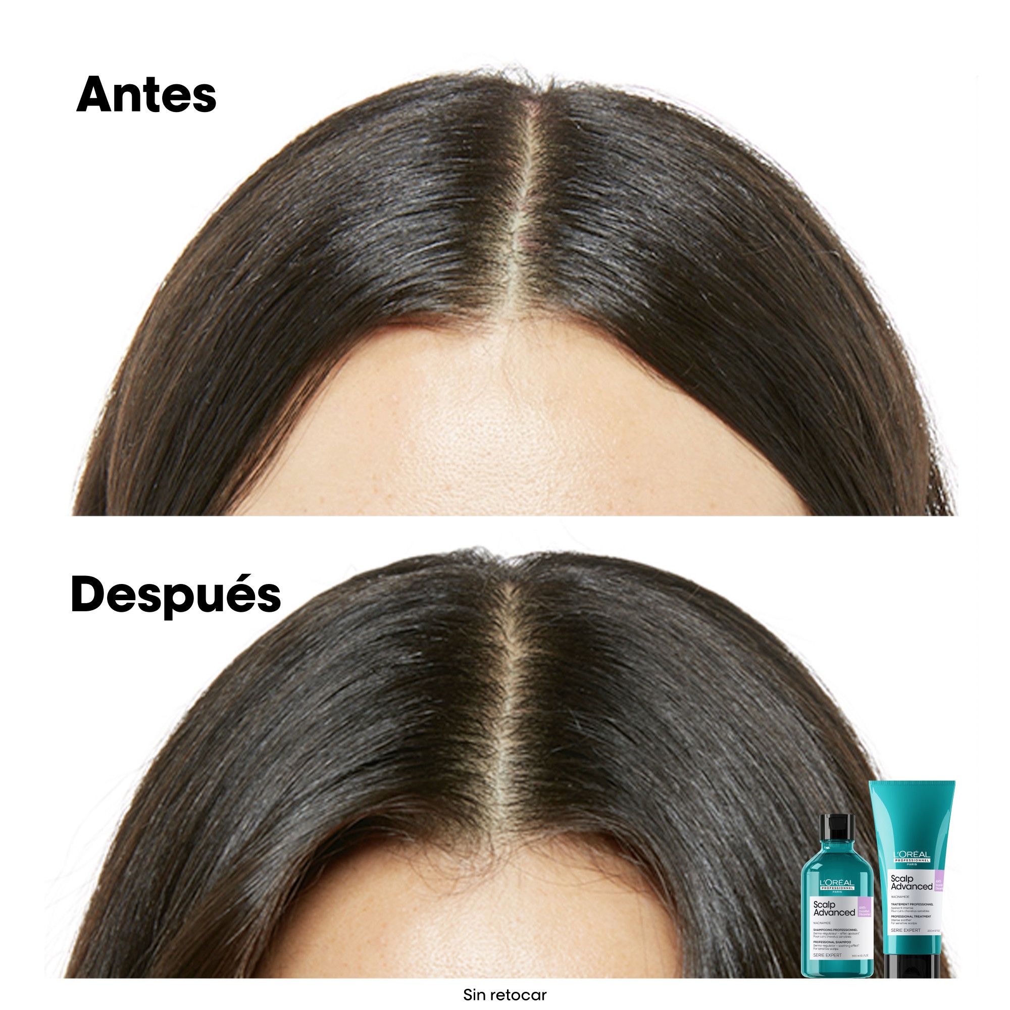Serie Expert Scalp Advanced Dermo-Regulating šampon, dopuna Šamponi za salone