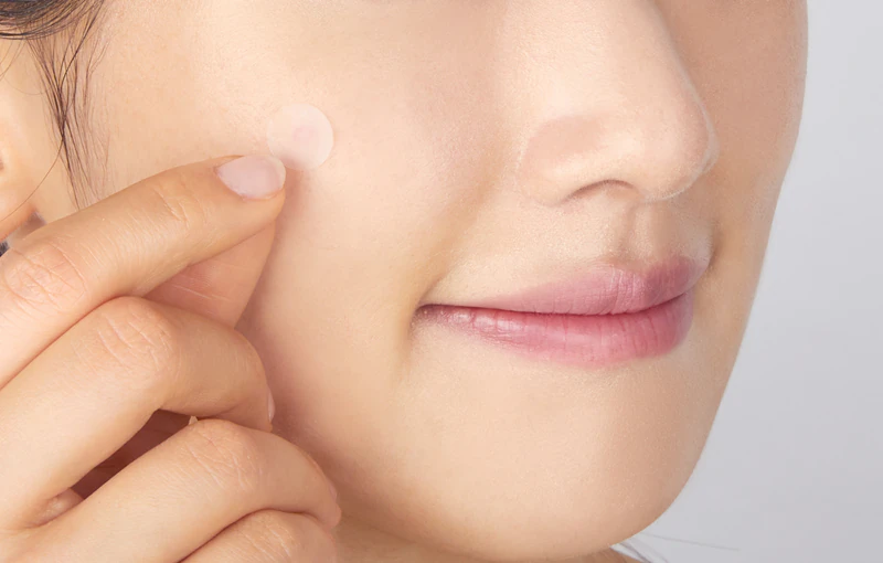 Adesivos Cica Spot Patch da VT Cosmetics para pele problemática.