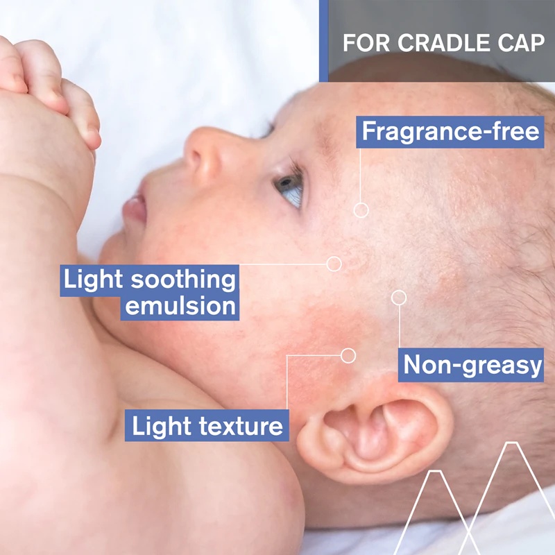 Uriage Bébé 1st Cradle Cap Care Cream pomirjujoča krema