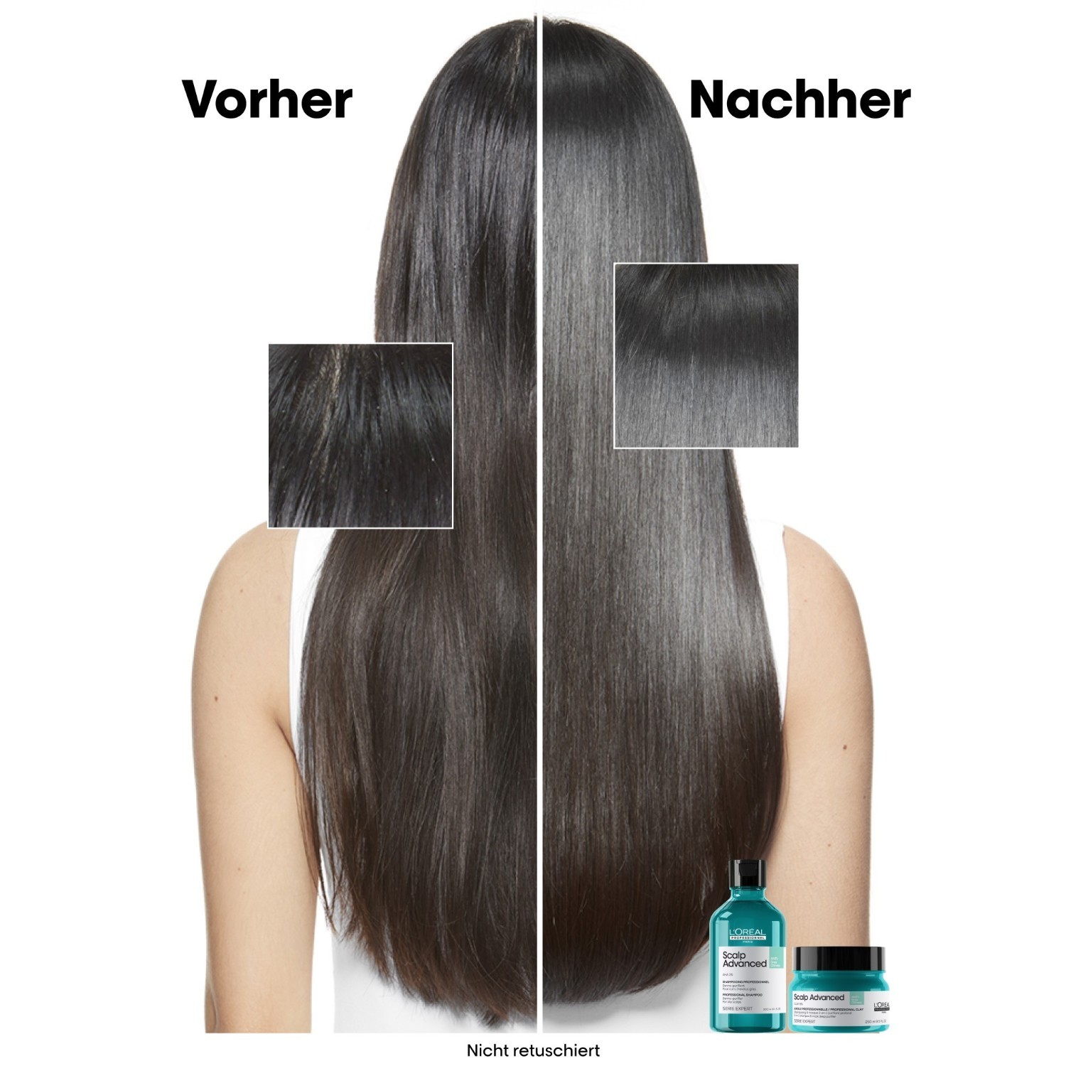 „L'Oréal Professionnel“ galvos odos plaukų kaukė – 2 viename giliai valantis molis, skirtas nutukimui gydyti, 250 ml