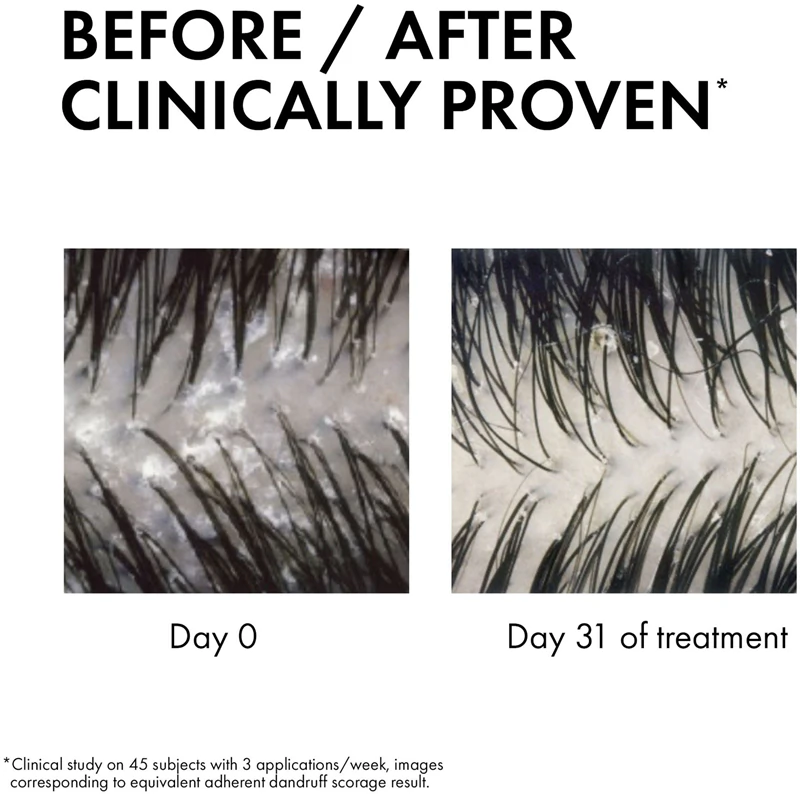 Vichy Dercos Anti-Dandruff šampón a kondicionér proti lupinám 2 v 1