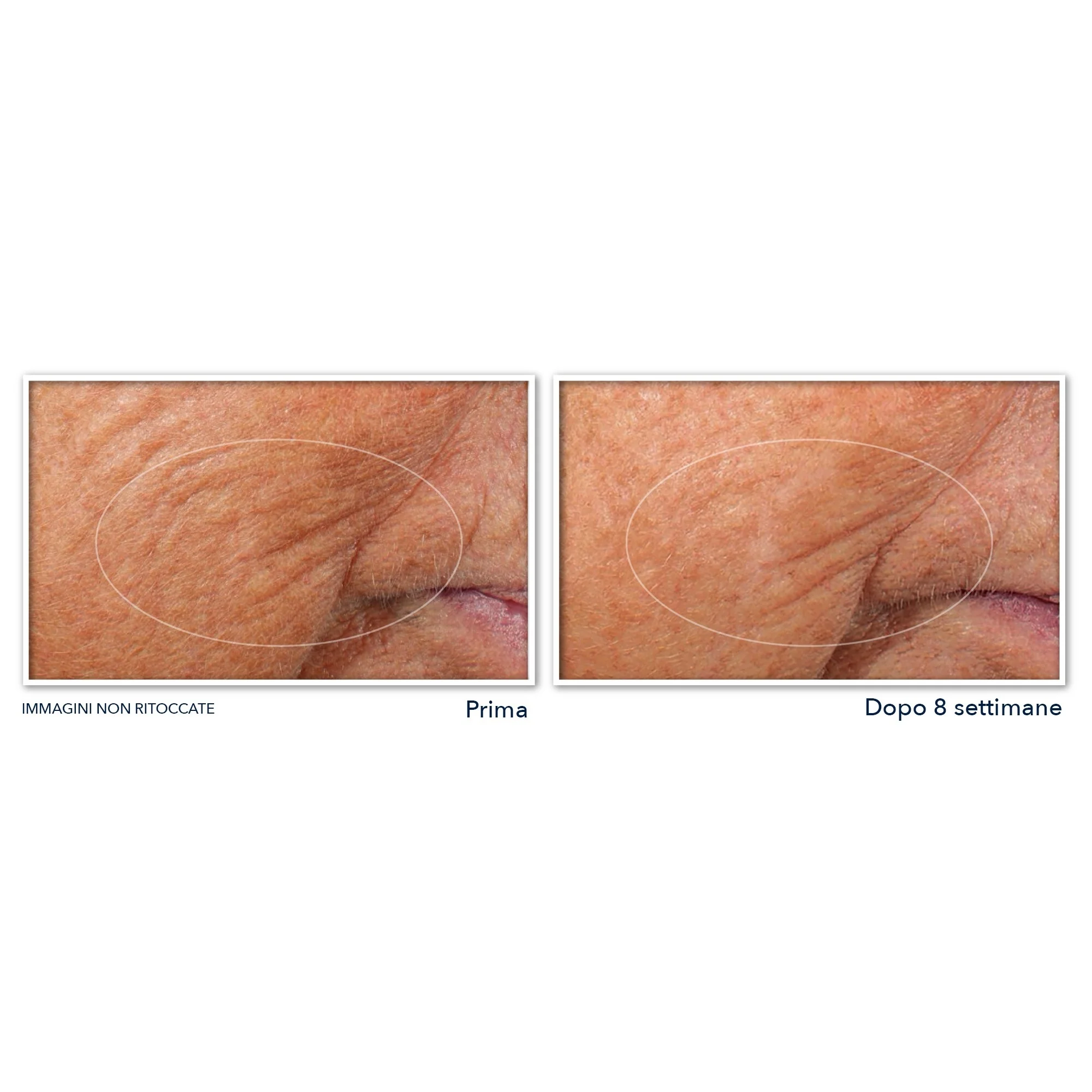 Retinol Correxion Line Smoothing Siero Viso Notte in Capsule - Tratt.viso notte antirughe, Siero viso antirughe