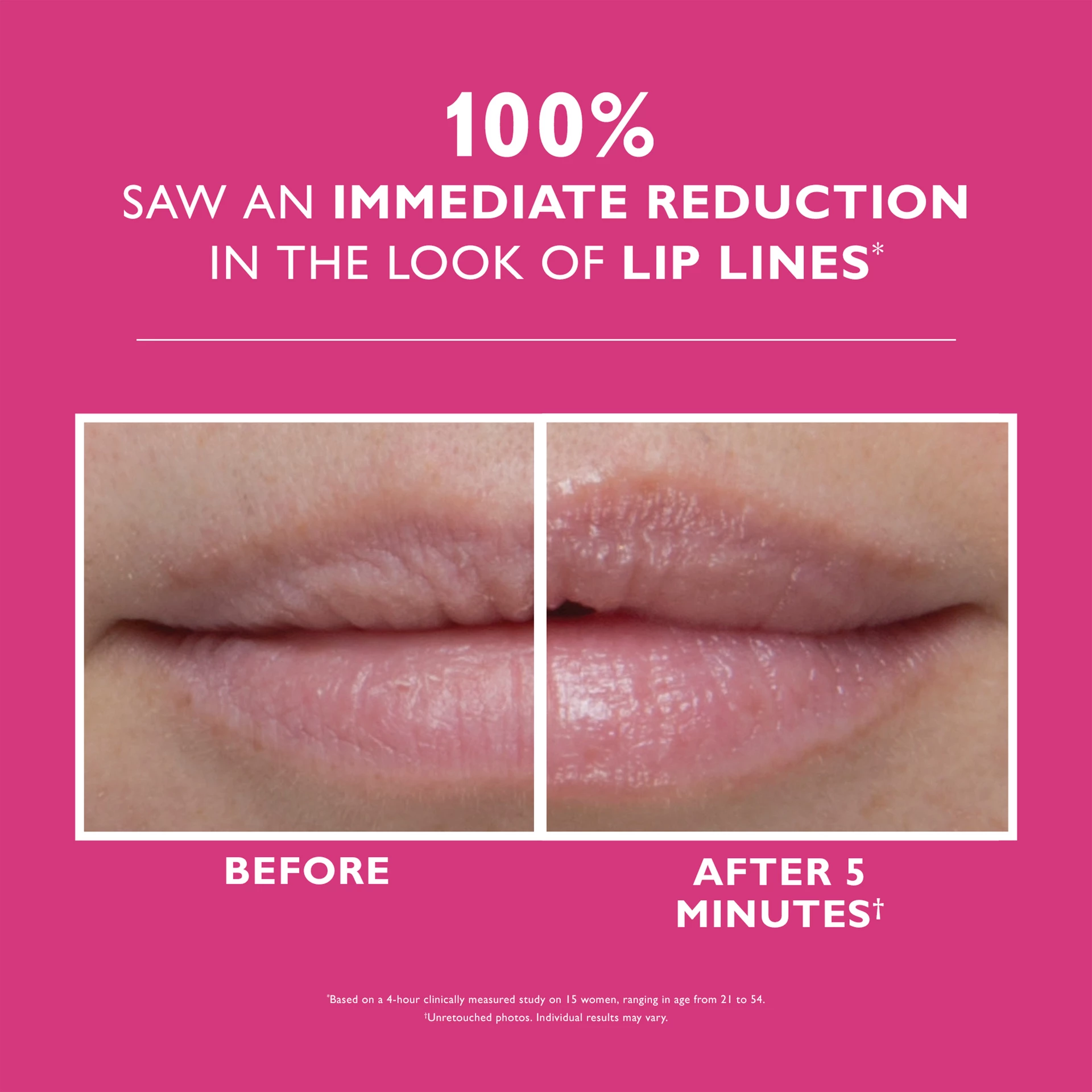 Umplere de buze instant FIRMx® 10 ml - Peter Thomas Roth