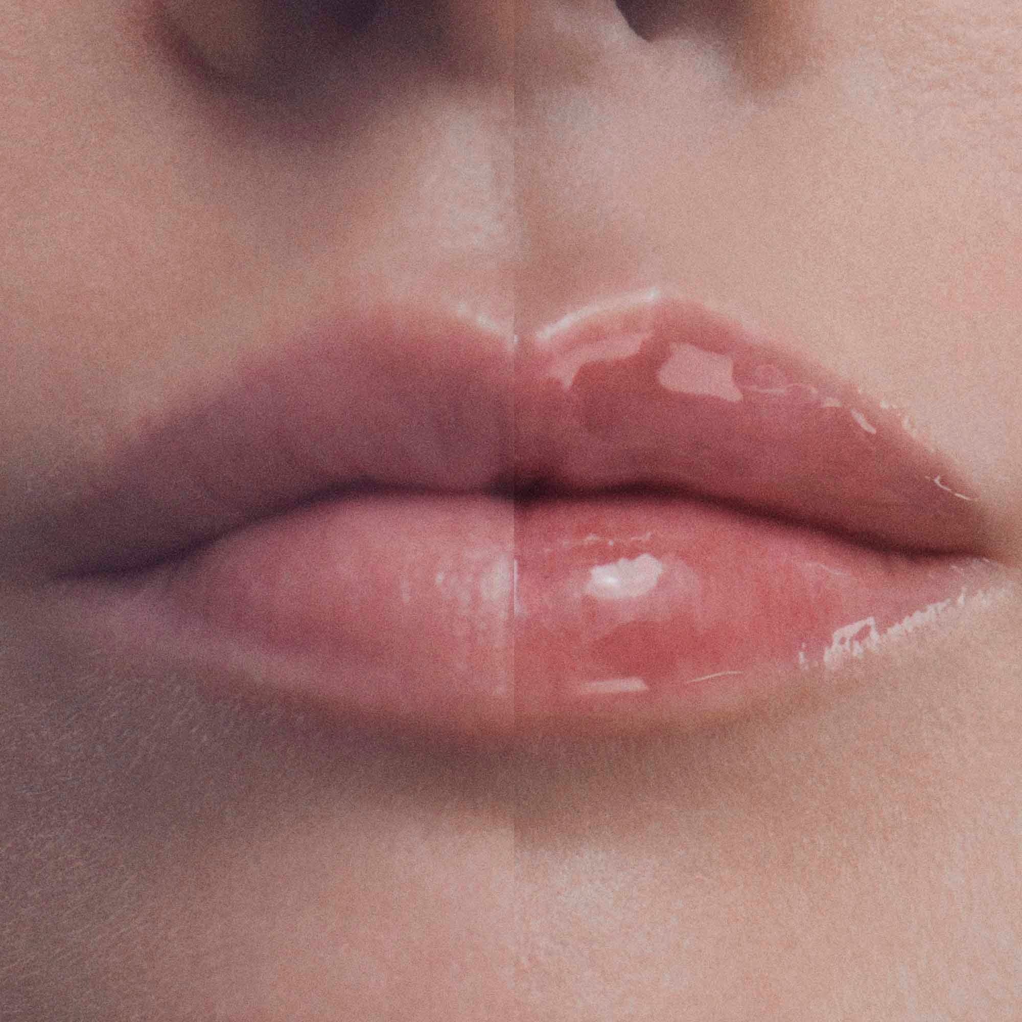Hyalu-Filler Balsamo Labbra - Volumizzante Labbra, Gloss