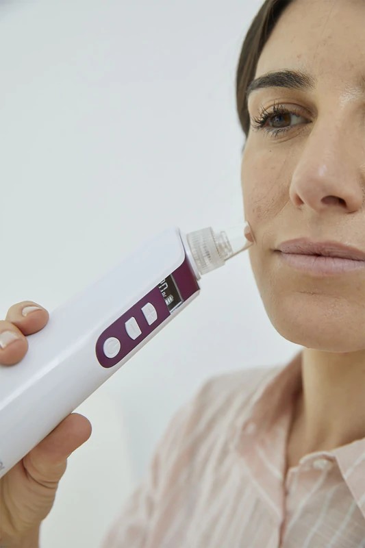 Prístroj na mikrodermabráziu BEURER FC 41