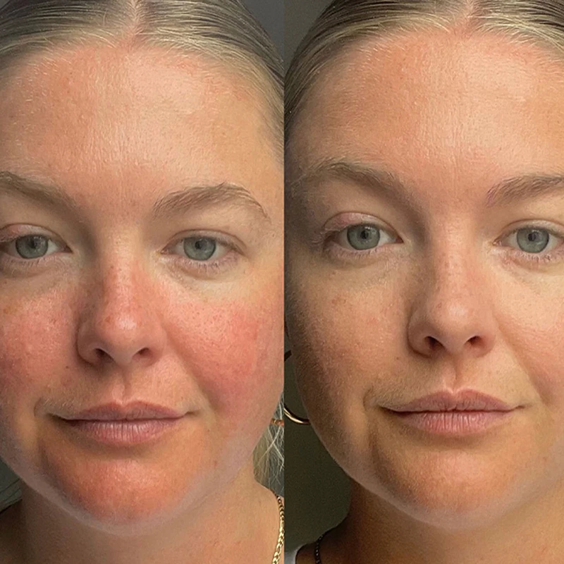 Dr. Jart+ Cicapair™ Tiger Grass Camo Drops SPF 35 lekki fluid tonujący