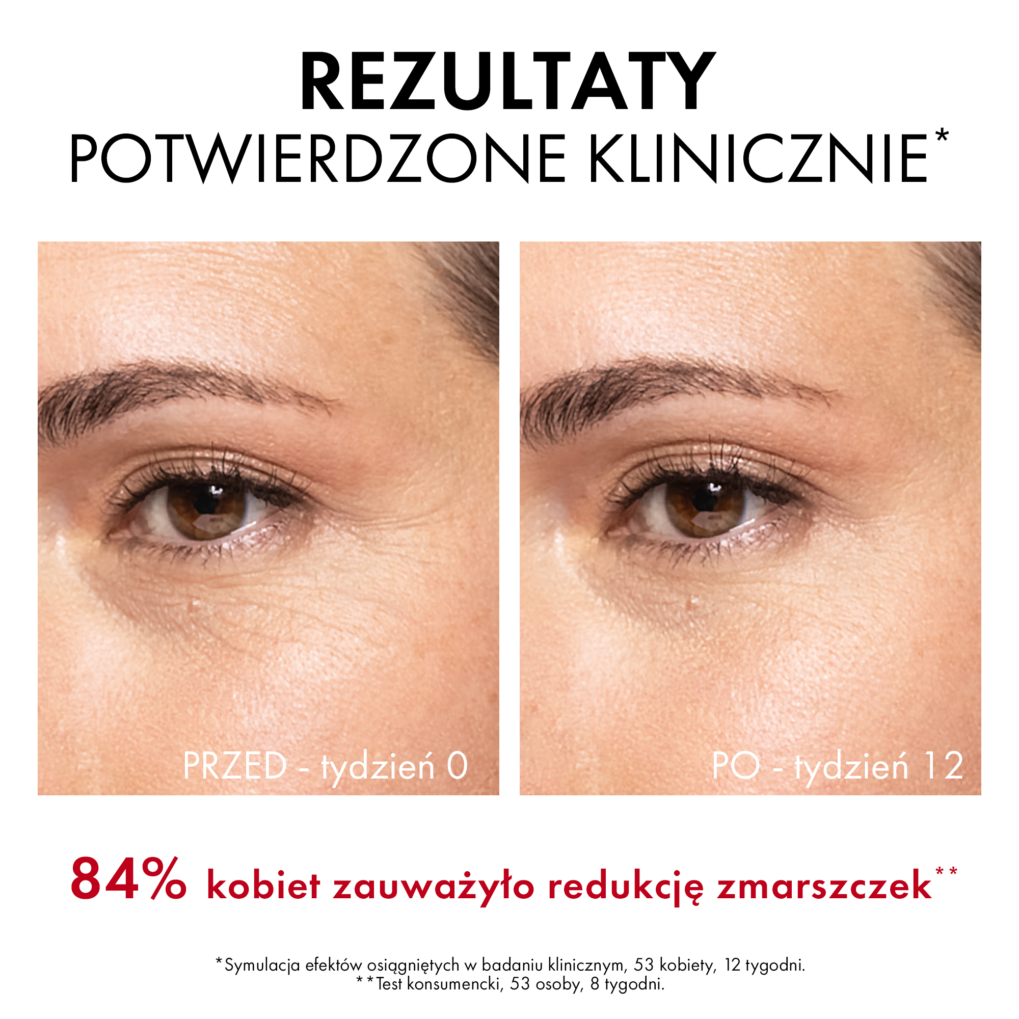 Vichy Liftactiv Specijalni Kolagen