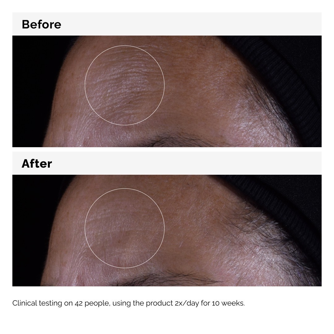 The Ordinary Anti-Aging Serum GF Solution 15% - 30 ml