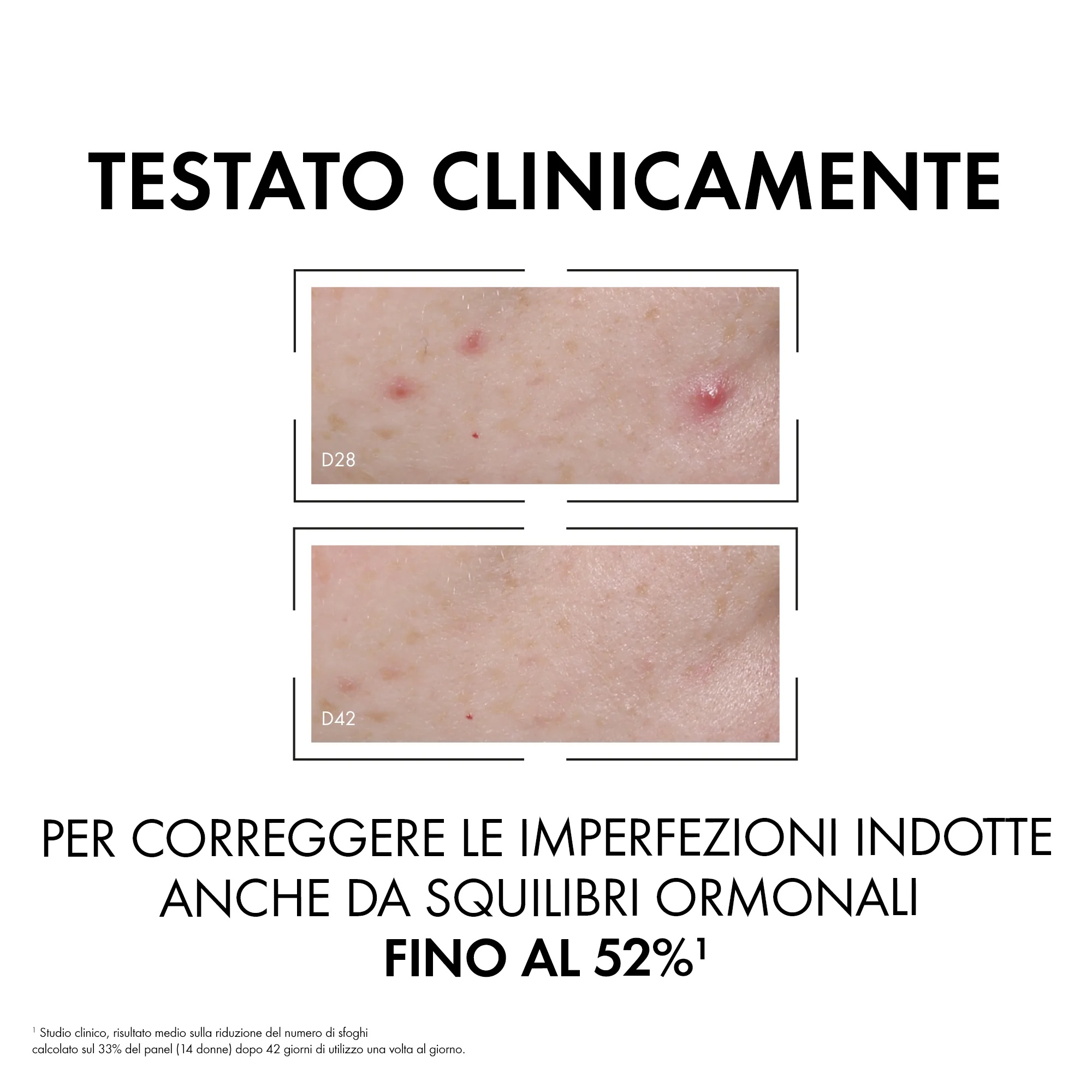 VICHY Normaderm Probio-Bha Serum tegen imperfecties 30 ml