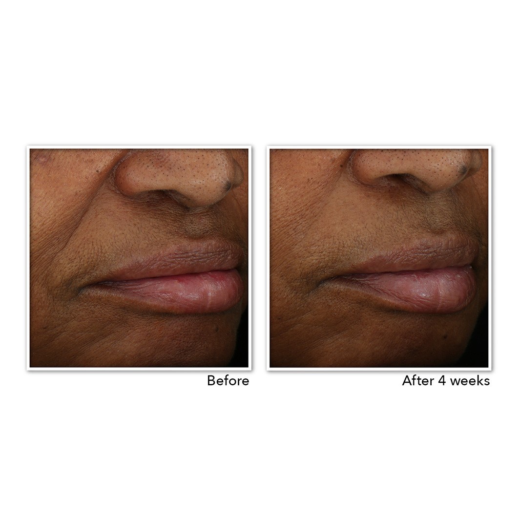 RoC RoC Renouveau + Éclat Gel Crème Hydratant 50ml