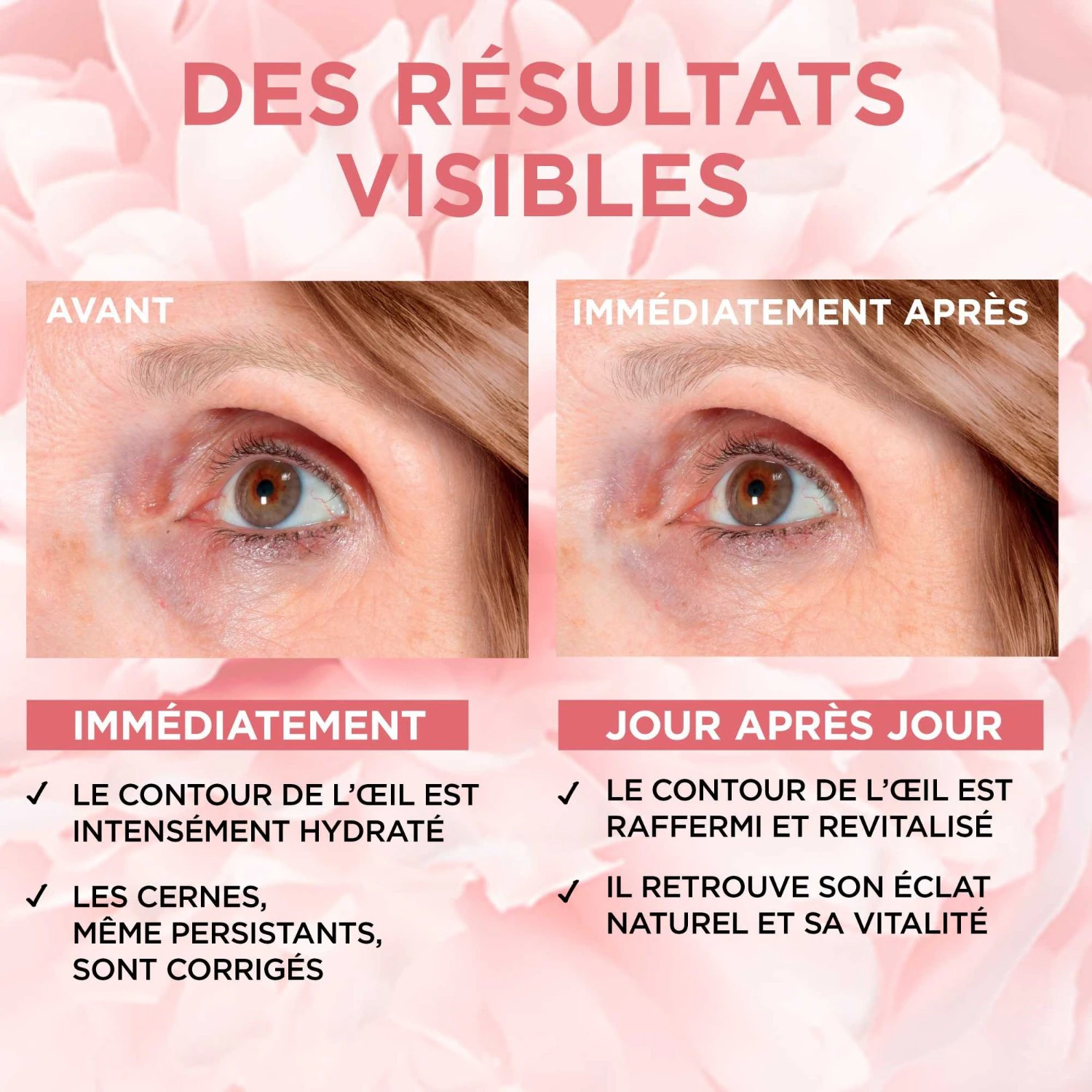 L’Oréal Paris Golden Age Soin Yeux Rosé Éclat