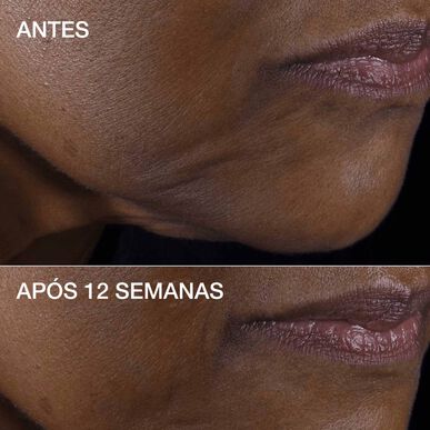 Clinique Creme Rosto Smart Clinical RepairTM Lifting 75ml 75ml