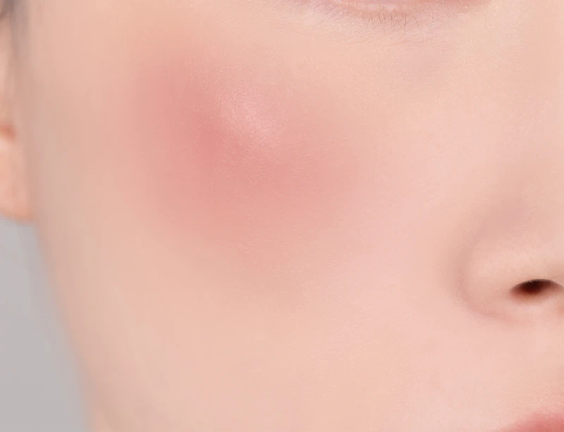 Blush Romântico da Banila Co. é um produto de maquiagem multifuncional para lábios e bochechas que proporciona um visual perfeito.