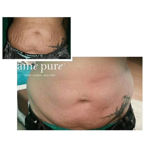 âme pure Body Basic