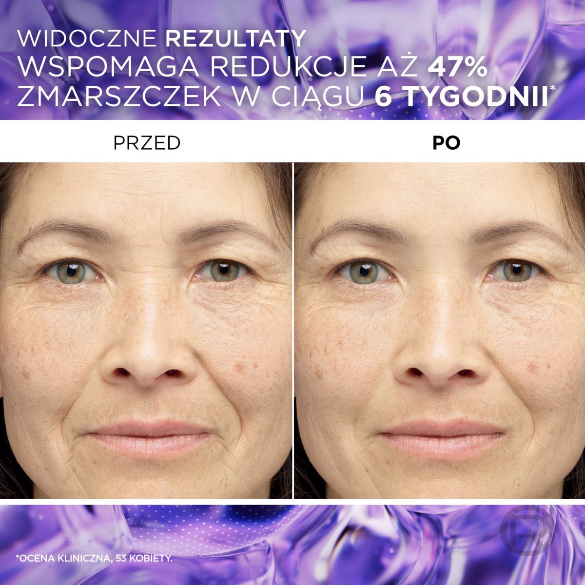 L'Oréal Paris Revitalift Filler