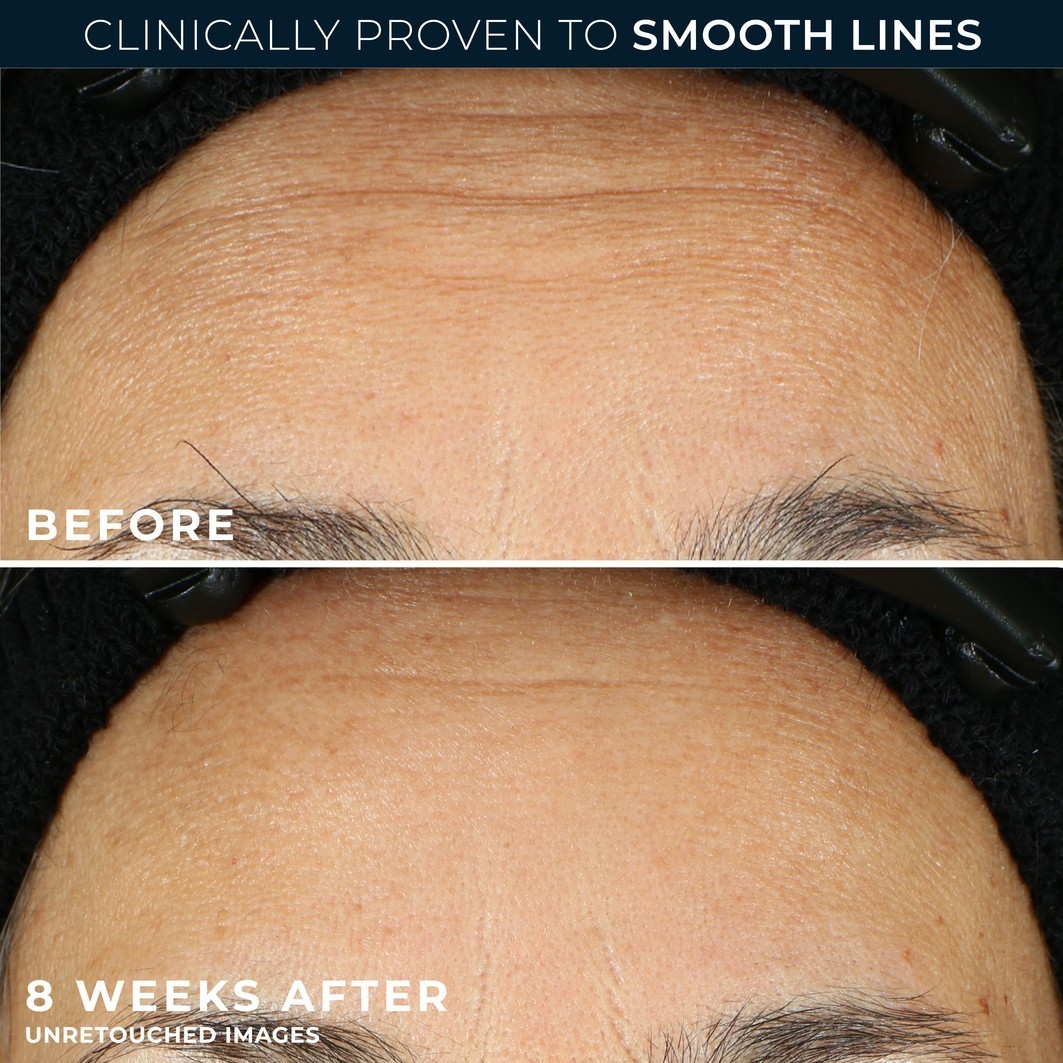 RoC drėkinamasis serumas Retinol Correxion Line Smoothing Night 30 kapsulių - 1 vnt.