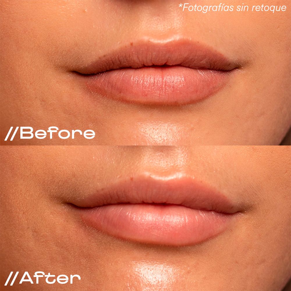 Balzam za ustnice Oh My Lips Zaščita za ustnice
