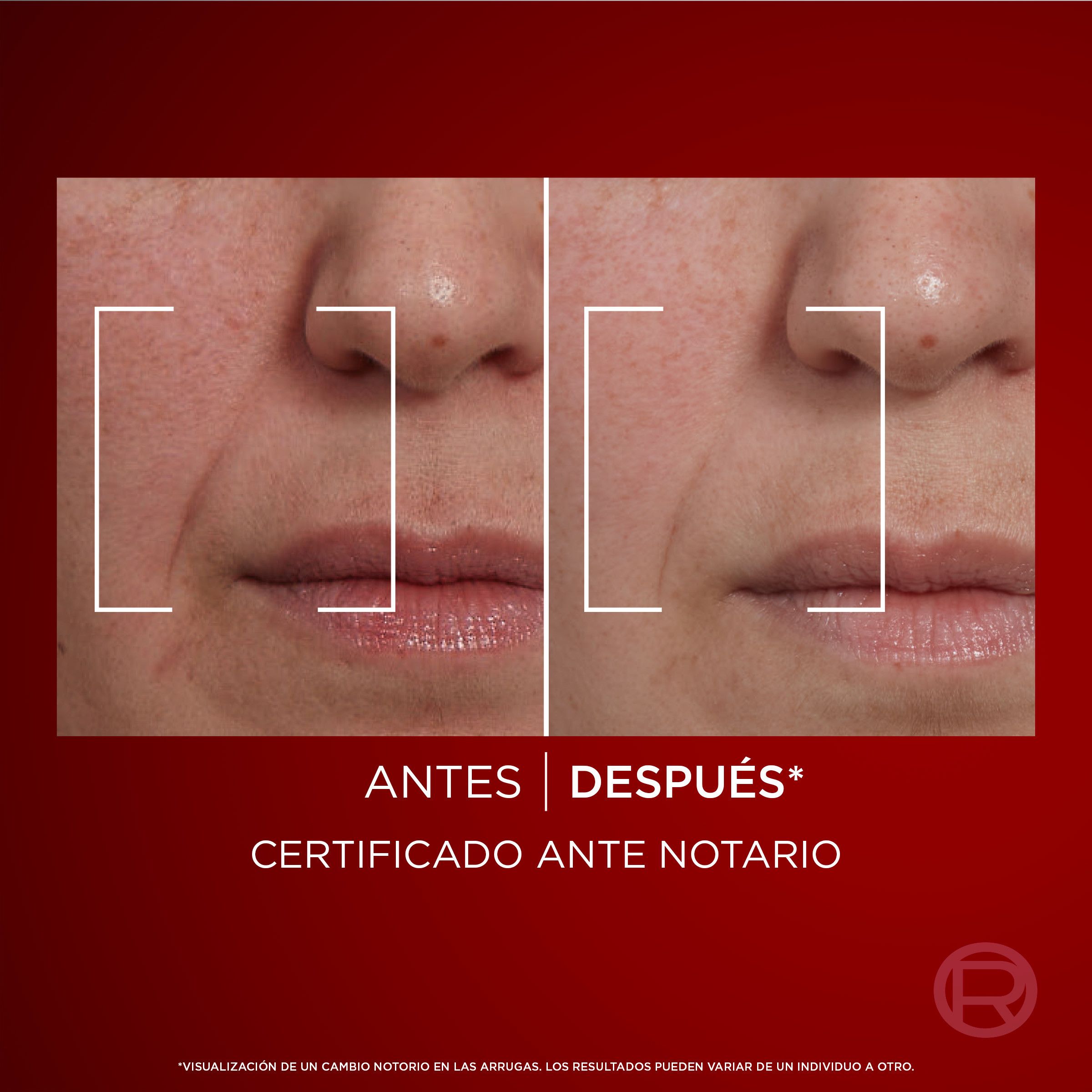 Revitalift Laser дневна крема Креме против бора и старења
