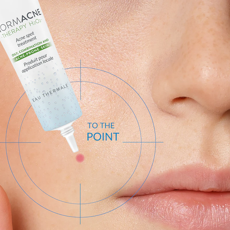 Dermedic Normacne Therapy: Tratamento localizado para lesões de acne.