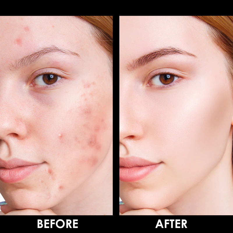 Arval Puractiva Bio-Balancing Cream čistiaci krém s regeneračným účinkom
