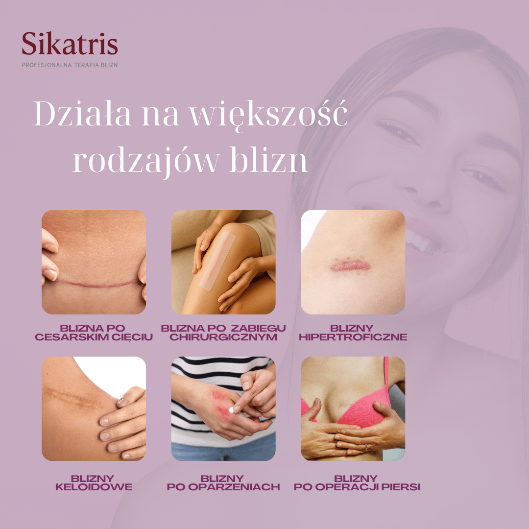 Biovena Sikatris