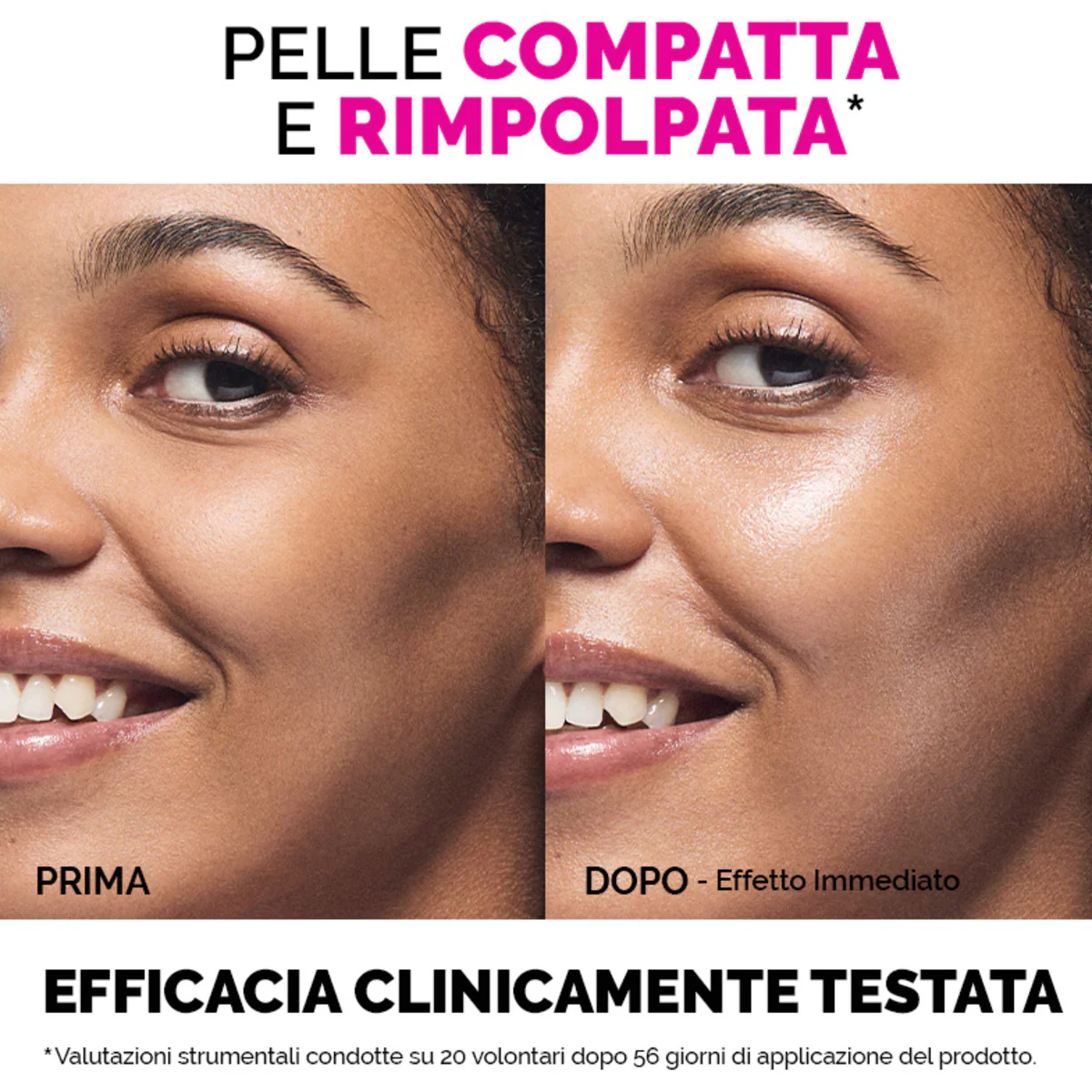 Sieri Viso Uplift Siero Viso - Siero viso antirughe